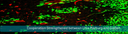 PM_Tumorforschung_Immunologie_KKS-en.gif