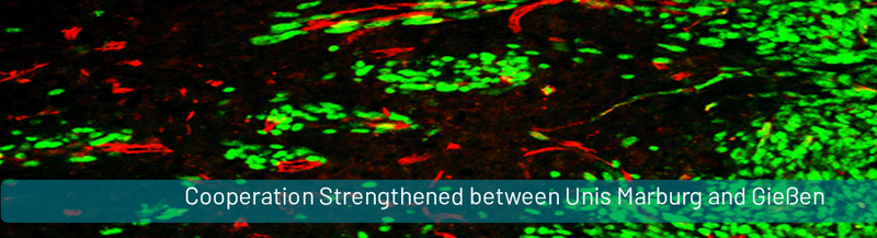 PM_Tumorforschung_Immunologie_KKS-en.gif