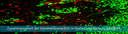 PM_Tumorforschung_Immunologie_KKS.gif
