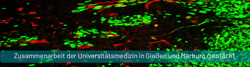 PM_Tumorforschung_Immunologie_KKS.gif