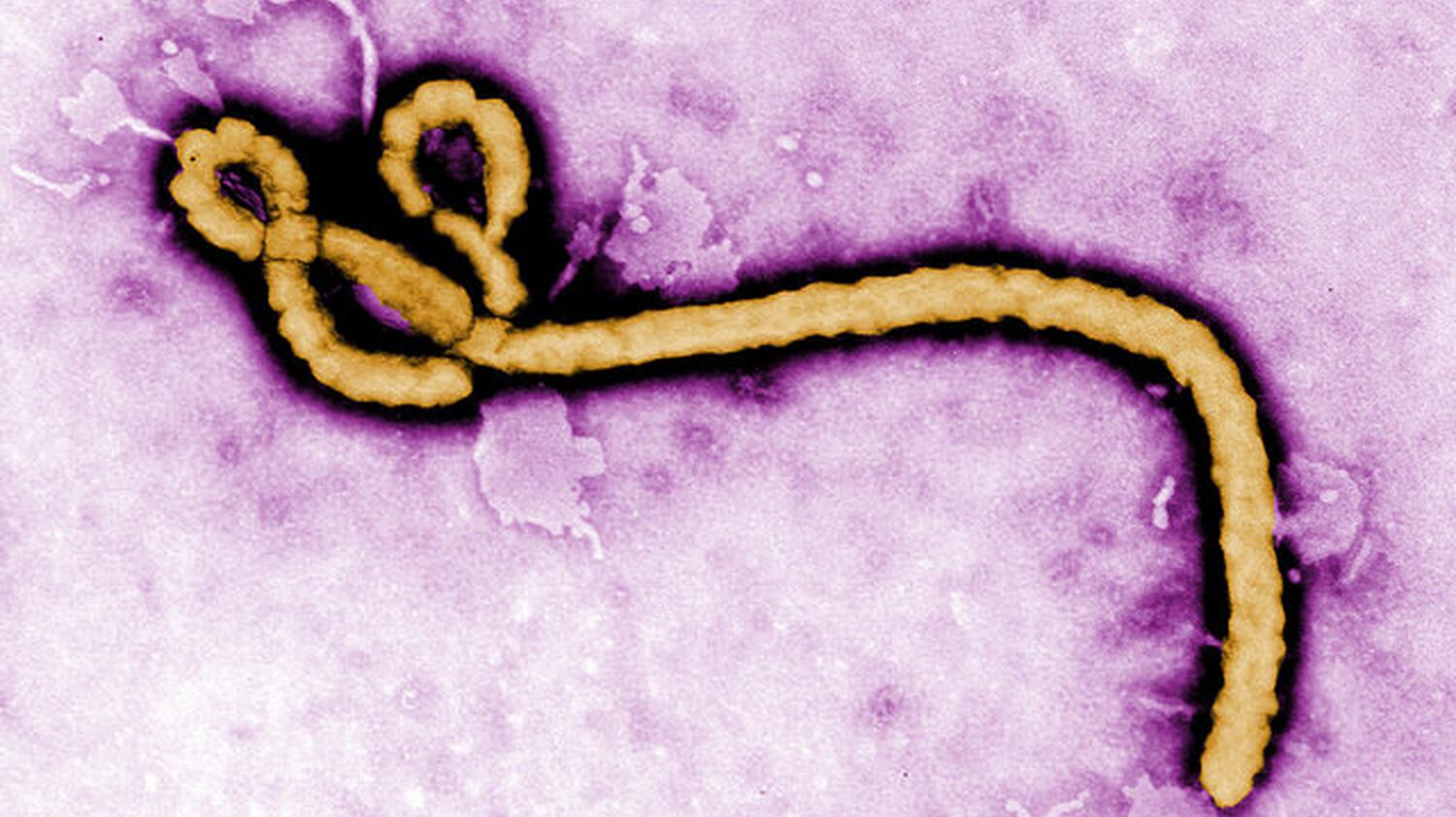 Prof. Dr. Stephan Becker (UMR) und weitere Expert*innen ordnen Ebola-Ausbruch ein